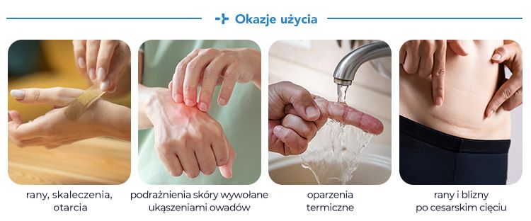 3a_banner_Octenisept_strefa-marki.jpg